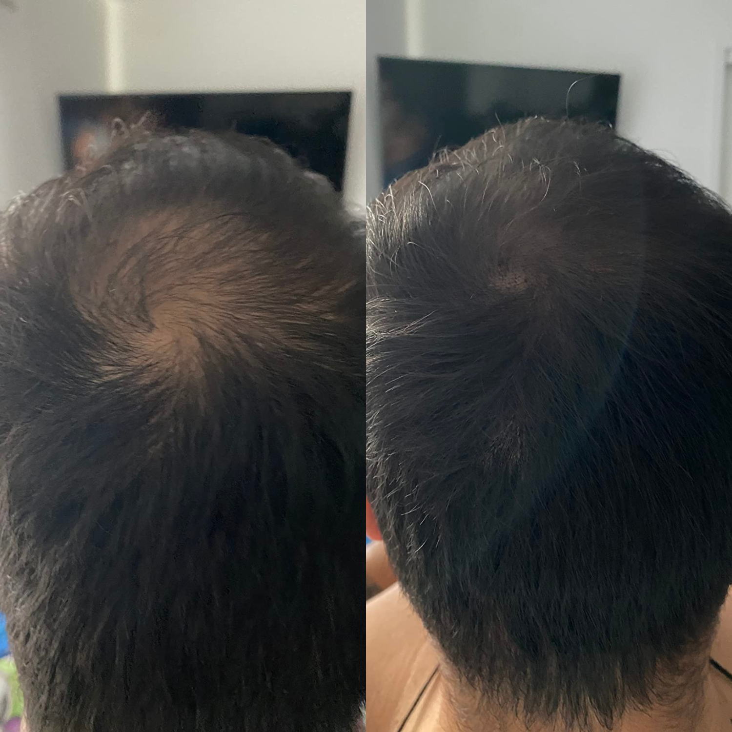 Folicure - Hair Spot Darkening Powder