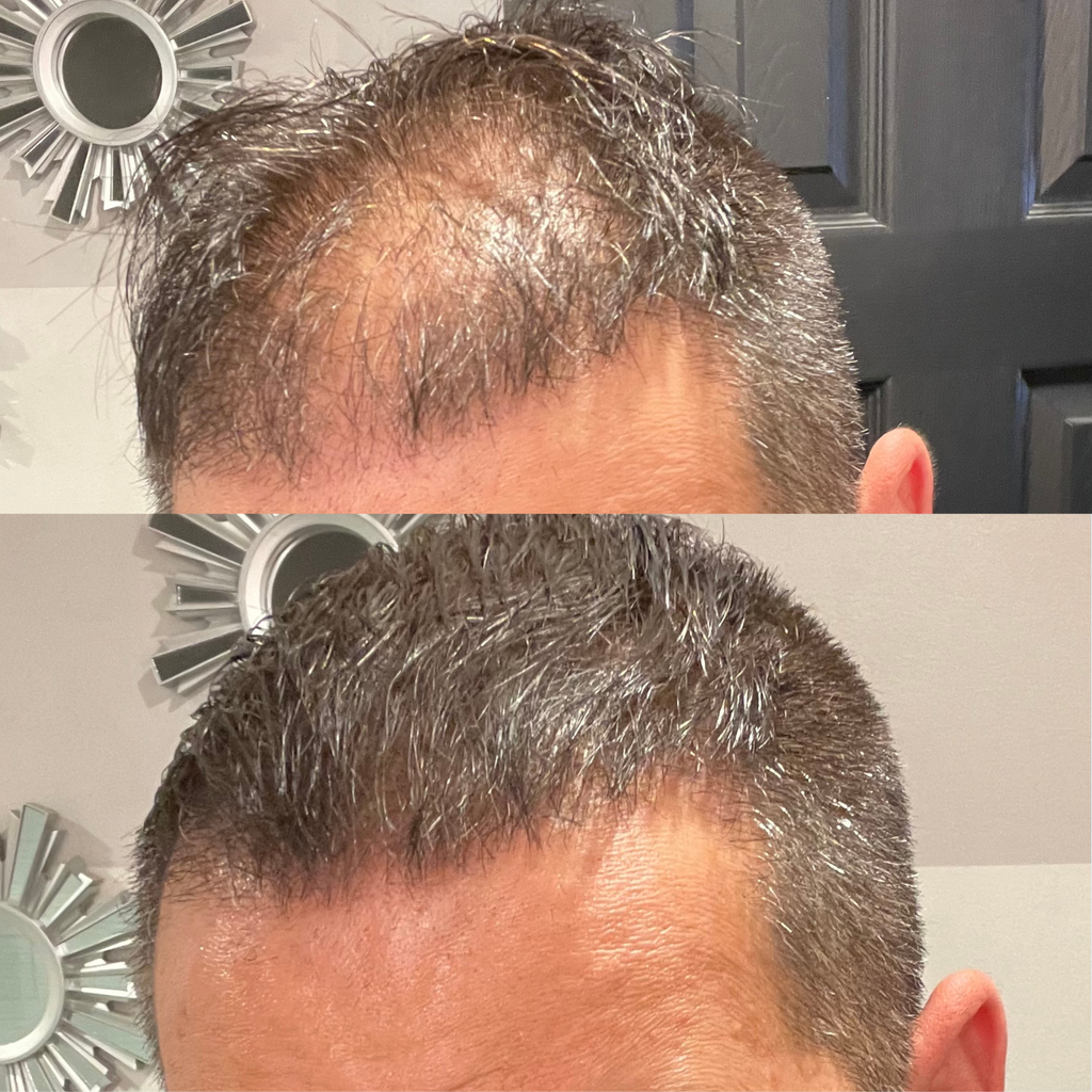 Folicure - Hair Spot Darkening Powder