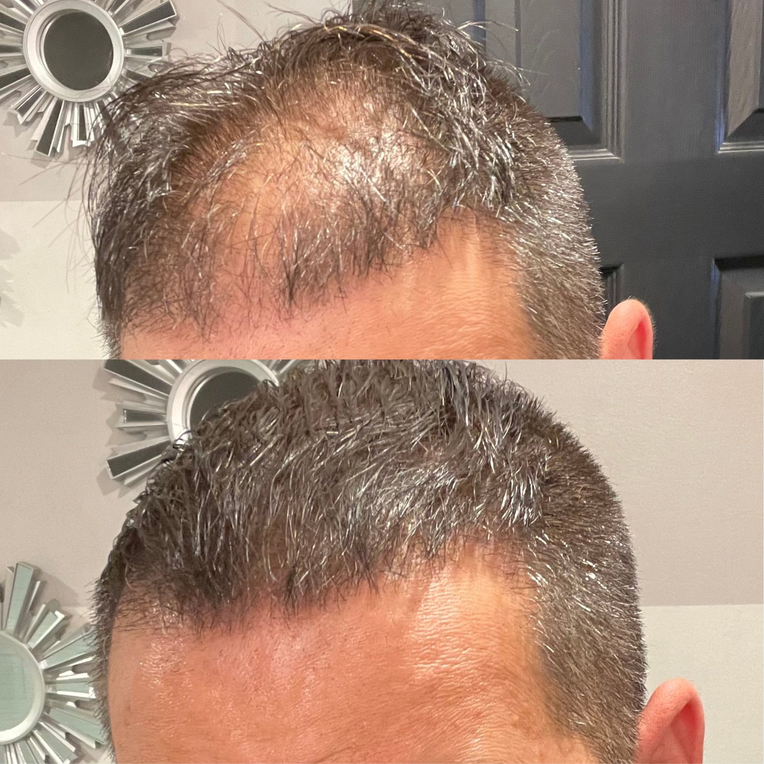 Folicure - Hair Spot Darkening Powder