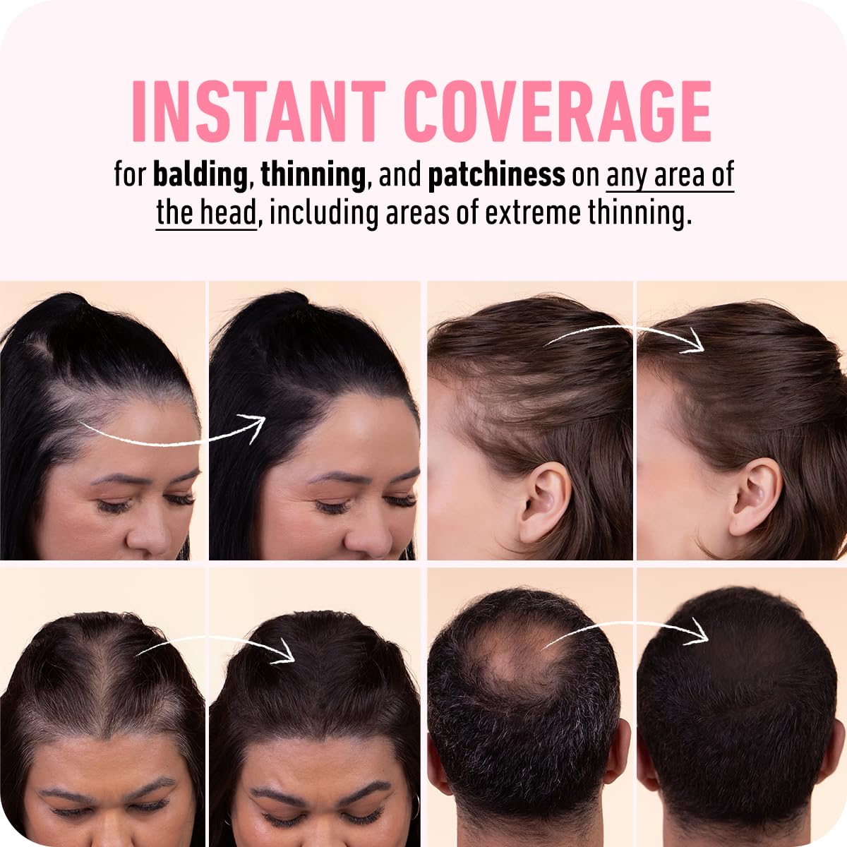 Folicure - Hair Spot Darkening Powder